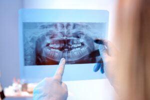 gentle dentist sedation dentistry